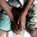 Ghana records eight mpox cases