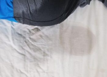 Winneba: Stepmother pours hot water on girl’s private parts over bedwetting