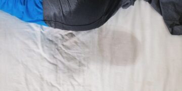 Winneba: Stepmother pours hot water on girl’s private parts over bedwetting