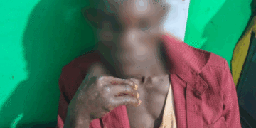 Juaboso: Man arrested for stabbing relative in eyes with scissors during dispute