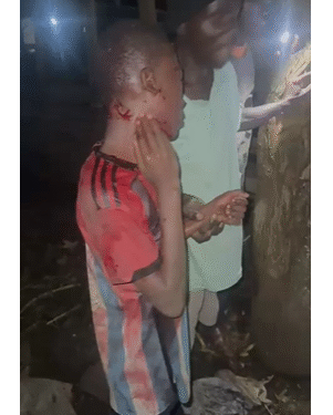 E/R: Police arrest 24-year-old apprentice for alleged attempted attack on brother