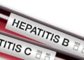 Health Ministry: About 3m Ghanaians unaware they have hepatitis B and C