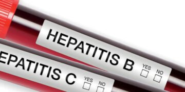 Health Ministry: About 3m Ghanaians unaware they have hepatitis B and C