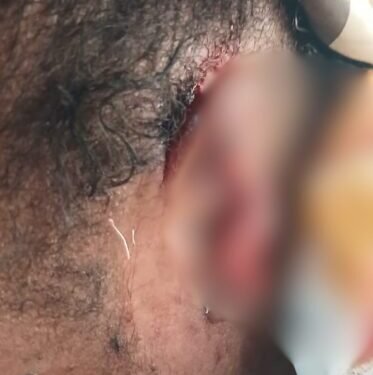 Barekese: Landlord’s wife arrested for allegedly biting tenant’s ear during fight