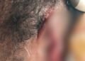 Barekese: Landlord’s wife arrested for allegedly biting tenant’s ear during fight