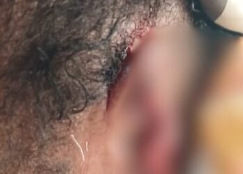Barekese: Landlord’s wife arrested for allegedly biting tenant’s ear during fight