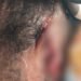 Barekese: Landlord’s wife arrested for allegedly biting tenant’s ear during fight