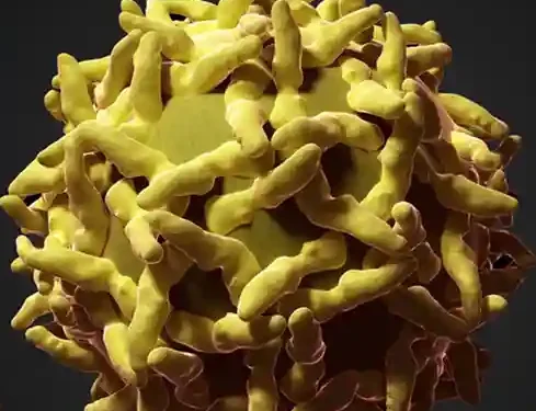 Yellow fever outbreak: Three confirmed dead in Upper West – Health Ministry