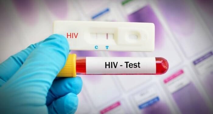 Ghana launches online HIV self-test system to improve access to testing