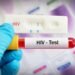 Ghana launches online HIV self-test system to improve access to testing